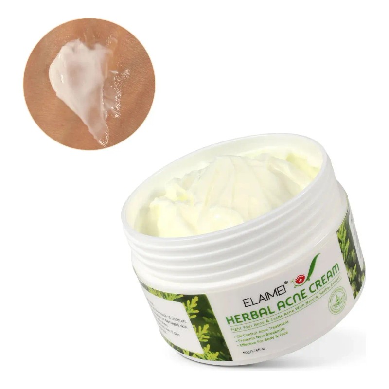 Crema Herbal Antiacné Control Grasa, Granos Espinillas 2 Pzs Acneica