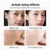 28pcs VC Ampoule Skincare Serum High Concentration Moisturizing Fade Fine