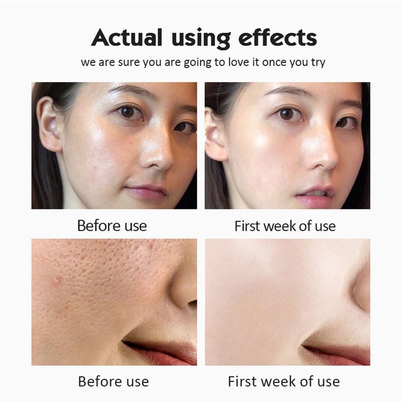 28pcs VC Ampoule Skincare Serum High Concentration Moisturizing Fade Fine