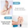 Pack of 9 Mineral Replacement Rollers for Scholl Callus Remover,