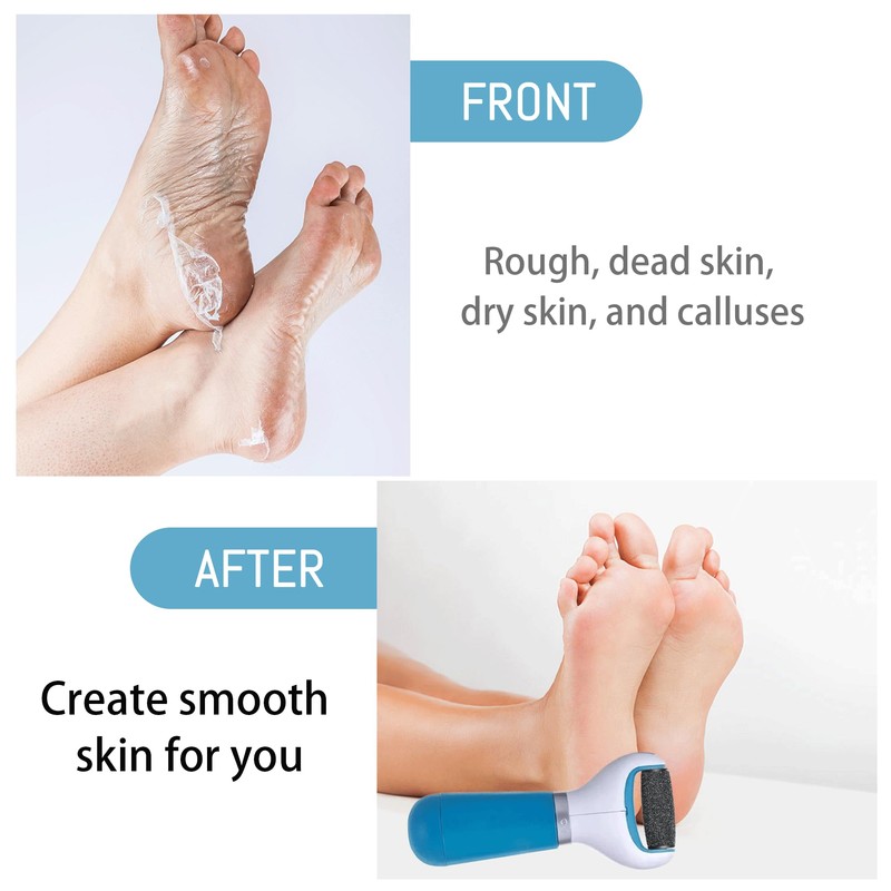 Pack of 9 Mineral Replacement Rollers for Scholl Callus Remover,