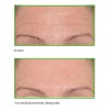 Murad - Set Rellenador De Arrugas Instantaneo
