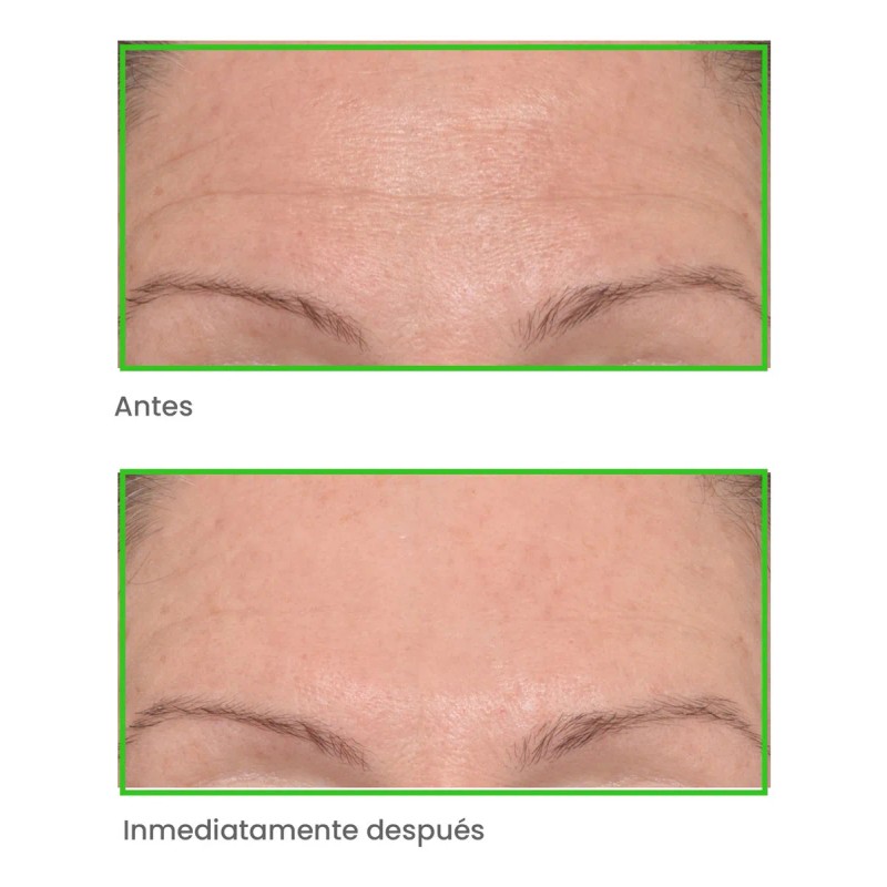Murad - Set Rellenador De Arrugas Instantaneo