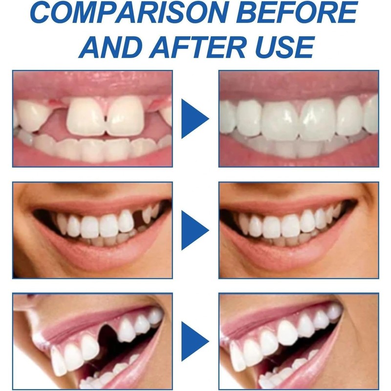 Fix Broken or Missing Teeth with Temporary Tooth Filling Restoration