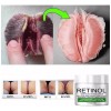 Kit 2 Cremas Blanqueadora Cuerpo Zonas Intimas Codos Cuello