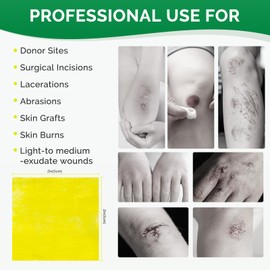 Greetmed Xeroform Petrolatum Dressing 2inx2in 25 Individual Pack Wound Dressing, Non-Adherent Gauze Pads for Wounds, Partial Thickness Burns, Lacerations, Skin Grafts, Recipient Sites, Sutured Wounds