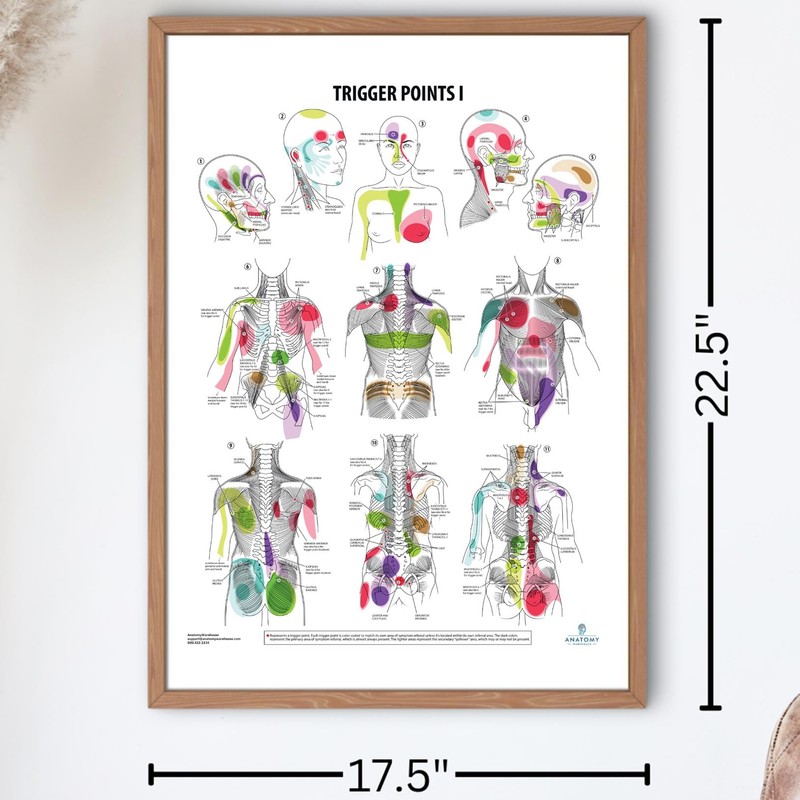 Anatomy Lab Trigger Points I Poster, LAMINATED, Anatomy and Physiology
