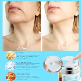 Lucoss 50ml Neck Firming Cream, Hibiscus & Honey Neck Creams for Tightening and Firming, Anti-Wrinkle Firming Cream for Neck and Face, Moisturizing & Hydrating with Collagen Retinol, Peptide