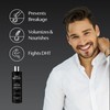 Dr. Bosley 2-in-1 Shampoo & Conditioner – Biotin & Saw