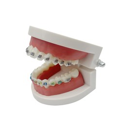 Dental Orthodontic Model, YOUYA DENTAL Demonstration Orthodontic Model Teeth Teach Study Tools with 1/2Metal and 1/2Metal self-Locking Bracket(Red)