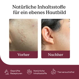 Health Routine Skin Care Pen 3er Pack — Hautpflegestift mit Mandelöl, Teebaumöl & Vitamin E, 100% Natürliche Wirkstoffe, Stift gegen Hautunreinheiten
