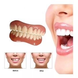 Generic,dientes postizos,blanqueador de dientes Sonrisa Perfecta, Ajuste Cómodo, Odontología Curva