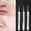 Kit de herramientas para eliminar espinillas, paquete de 7 herramientas