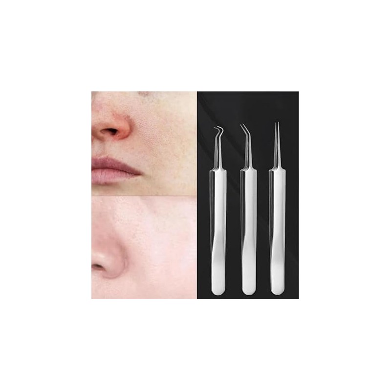 Kit de herramientas para eliminar espinillas, paquete de 7 herramientas