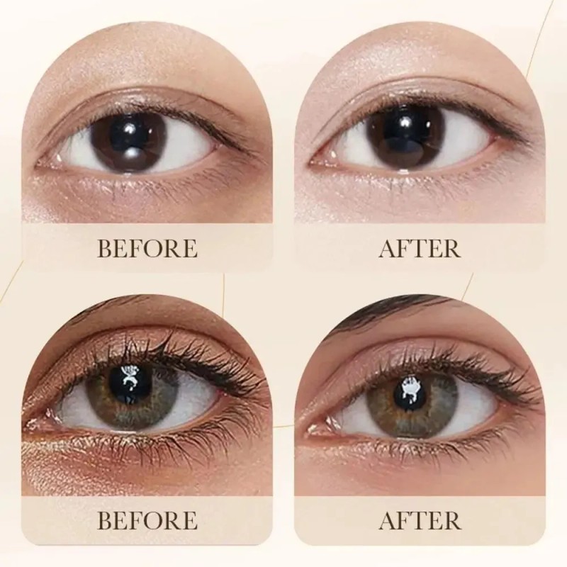 Parches Hidrogel Ojos Bioaqua De Arroz Elimina Ojeras F Todo
