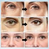 Parches Antiojeras De Colageno Reduce Ojos Cansados 60 Pcs Tipo