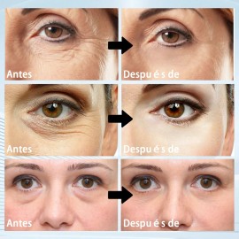 Parches Antiojeras De Colageno Reduce Ojos Cansados 60 Pcs Tipo De Piel Mixte-Contiene ácido hialurónico GROEI