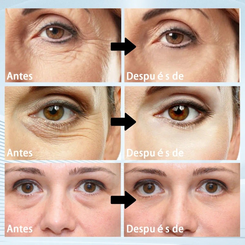 Parches Antiojeras De Colageno Reduce Ojos Cansados 60 Pcs Tipo