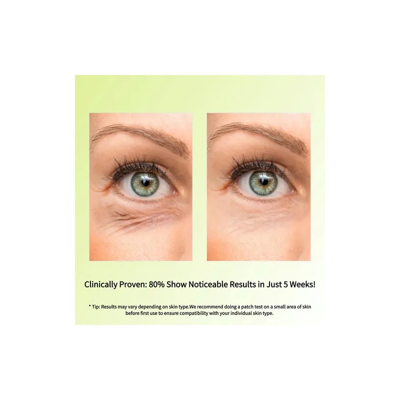 Crema De Ojos Antienvejecimiento Con Retinol 15 Ml Todo .