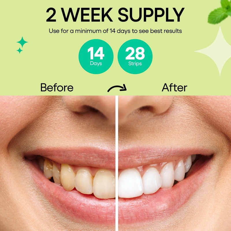 Premium Non Hydrogen Peroxide Teeth Whitening Strips | 28 Enamel
