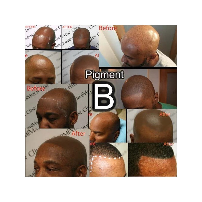 3-Pack - All SMP Scalp pigments - Half Oz