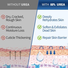 60% Urea Foot Cream - Foot Cream for Cracked Heels and Dry Skin - Urea Cream 60 Percent for Feet - Cracked Heel Repair Cream for Deep Moisturizing, Callus Remover and Soften,100g