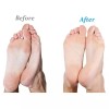 Emjoi 마이크로-페디 호환 SoftFLEX 기술 리필 롤러 (초굵기) - 4개