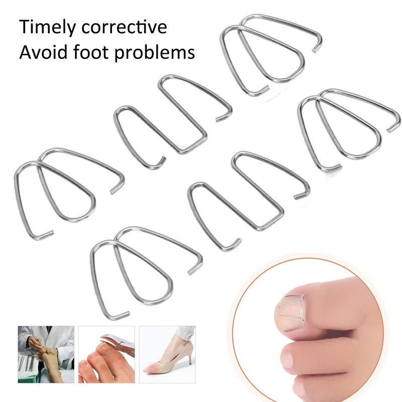 Nail Corrector Ingrown Toe Nail Wire Lifter Fixer Recover Tool