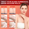 Silicone Scar Sheets (1.6”x 60” Roll-1.5M), Medical Grade Silicone Scar