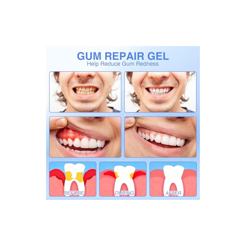Mullein Gum Repair Gel, Teeth Whitening Essence Pen, Gum Shield