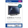 Media cover market for Sony BDP – SX910 (9 in