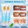 2Pack Niacinamide Whitening Toothpaste,Remove Tooth Stains,Niacinamide Intensive Toothpaste,Fresh Breath,7.06 oz