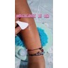 Atc Fluido Corporal Para Piel Con Textura Inrregular 20 Ml