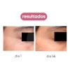 Vial Regenerex Cell - Células Madre + Silicio + Hialurónico Momento de aplicación Día/Noche Tipo de piel Todo tipo de piel