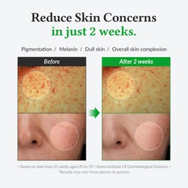 Dr.Althea [Dr.Althea]Gentle Vitamin C Serum 30ml