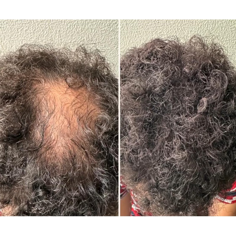 Capelli Fibras Capilares para Pérdida de Cabello, Polvo de Disimulación