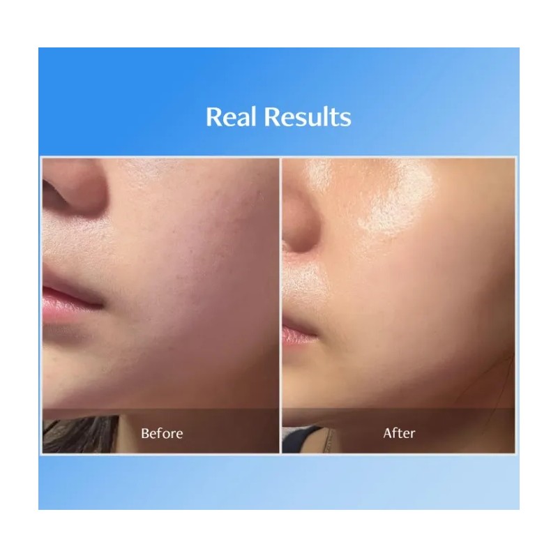 Meditherapy Blue Layer Double Water Cream 50g - K Beauty