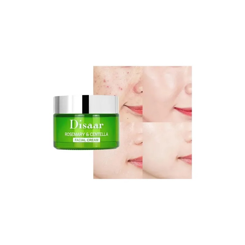 Crema Antimarcas + Hidratante + Suavidad Total + Natural
