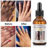 Aromixe 2 Pack Whitening Serum 30ml for Knuckles, Feet, Elbows,