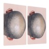 Man Bald Micropigmentattion Practice Skin Silicone Hairline Microblading Practice Pads