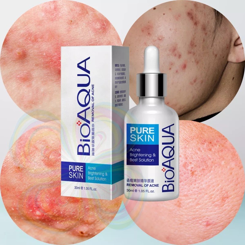 Bioaqua Crema+ Serum Bioaqua Pure Skin Tratamiento Anti-acne Manchas