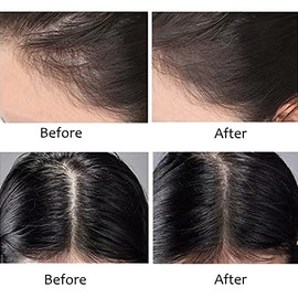 Barra de Polvo para El Cabello - Oculta Instantáneamente La Caída Del Cabello, Adelgaza El Cabello y Las Manchas Calvas - Retoque de Raíz Impermeable 