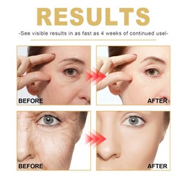 Xiulilydai Golden Age Refining Serum, 30ml, Erase Deep Wrinkles & Dark Spots, Anti-Aging Daily Serum