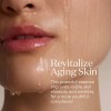 Sk-ii Lxp Ultimate Revival Essence Skincare - Esencia