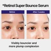 IOPE Retinol Super Bounce Serum | Korean Retinoid Eye Treatment