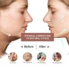 Double Chin Reducer V Line Face Lifting Tape Face Strap,
