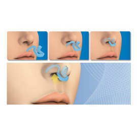 Anti Snoring Nose Dilator, Snoring Stopper Medium and for Sports – Tested by the Italian Olympic Committee – Made in Italy – Startup Kit – Colour Blue