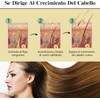 Aceite Natural Para el Crecimiento del Cabello, Aceite Orgánico De