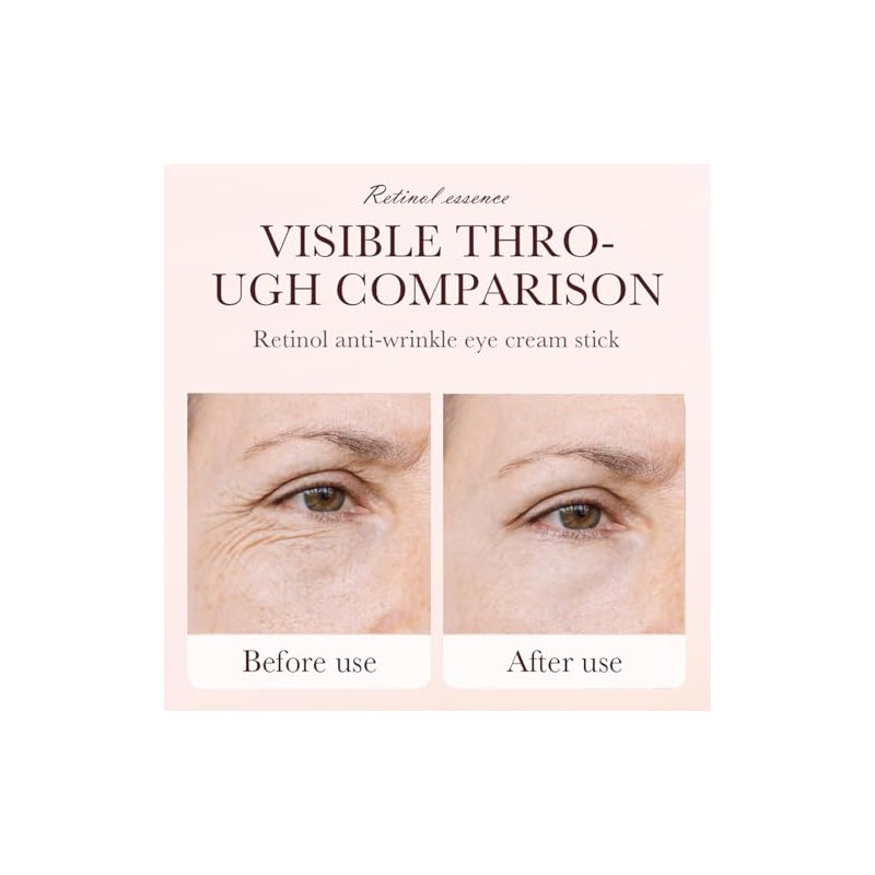 Retinol Eye Stick y Crema Contorno de Ojos en Barra