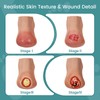MedEduQuest Heel Pressure Injury Stages Model, Ulcer Demonstration Model